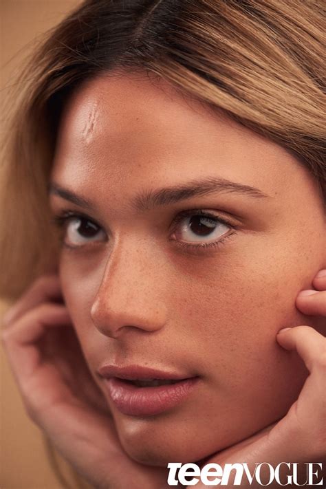 Meet 5 Models With Facial Scars | Teen Vogue