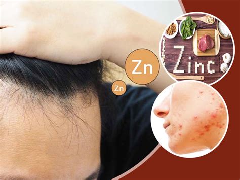 What Is Zinc Deficiency? Know Ways To Treat This Condition | OnlyMyHealth