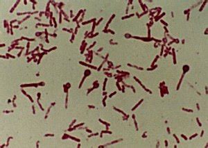 Clostridium Tetani Gram