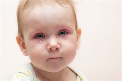 Conjuntivitis en niños: ¿qué debo hacer? - Mejor con Salud