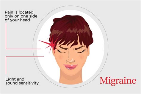 Headache Causes - LBF