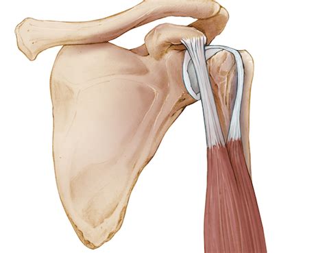 Distal Biceps Tendon Rupture Treatment