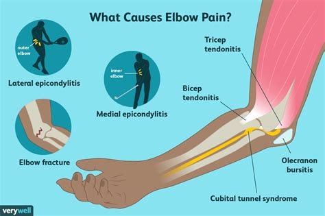 Elbow Pain: Causes, Treatment, and When to See a Healthcare Provider