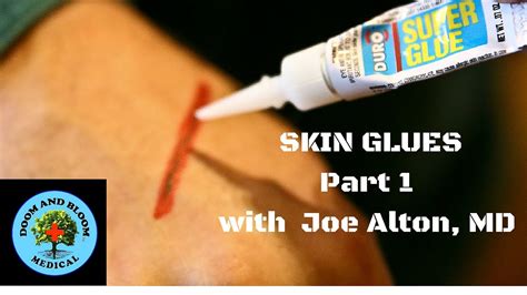 Skin Glues for Wound Closure Part 1 - YouTube