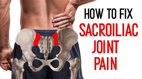 Sacroiliac Joint Pain - exercises for SI pain relief I Ask Your Pain ...