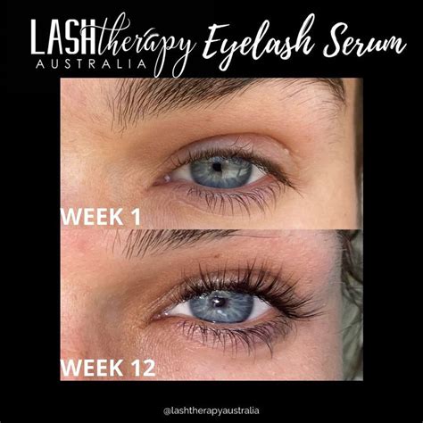 Eyelash Serum Before and After results | Eyelash serum, Natural lash ...