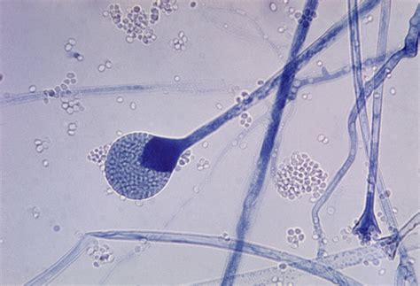 File:Mature sporangium of a Mucor sp. fungus.jpg - Wikimedia Commons