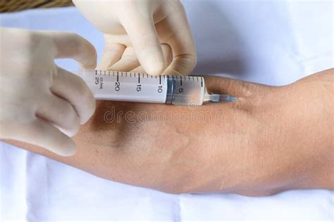 Injection into a vein stock image. Image of analyzing - 72777485