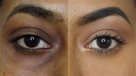 How To Cover Under Eye Circles Without Makeup | Makeupview.co