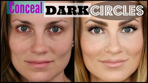 How To Disguise Black Circles Under Eyes | Makeupview.co