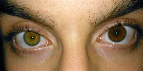 Why Does My Eye Color Change