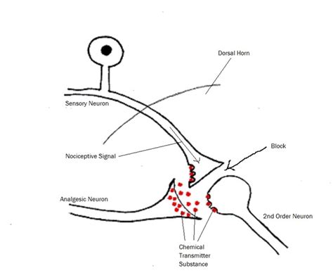 Descending Inhibition - HeadWorks Physiotherapy