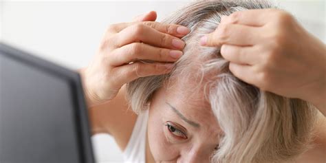 Scabs on Scalp Causes and Treatments, According to Doctors