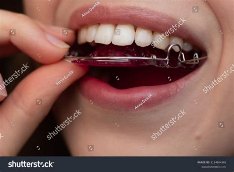 47,908 Retainer Images, Stock Photos & Vectors | Shutterstock