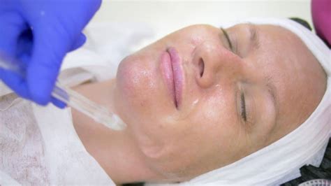 What Is Chemical Exfoliation? | Intermountain Aesthetics MD Spa