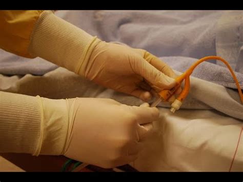 Foley Catheter Removal - YouTube