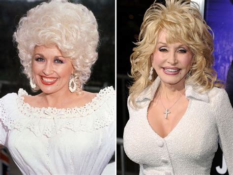 26 Over-The-Top Hollywood Plastic Surgeries | V103 | Dolly parton ...