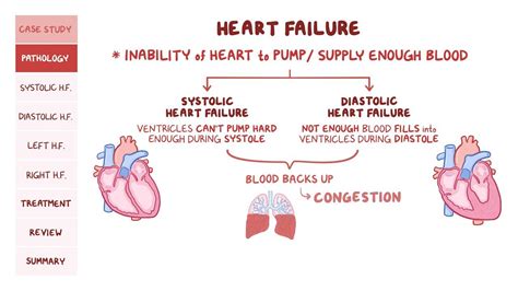 Understanding Heart Disease Anatomical Wall Chart AnatomicalStore 2023 ...