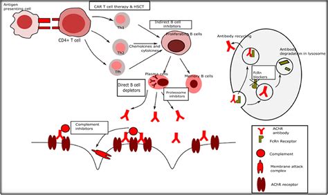 Myasthenia Gravis / Myasthenia Gravis Autoantibody Characteristics And ...