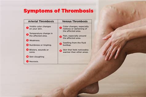 Symptoms of Thrombosis