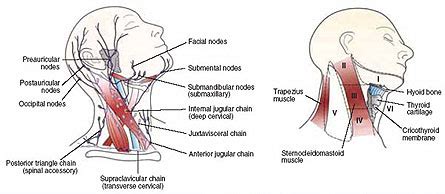 Lymph Node Removal Surgeons Chicago IL