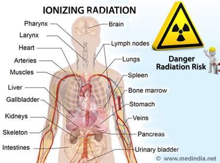 Infographic on Radiation Hazards