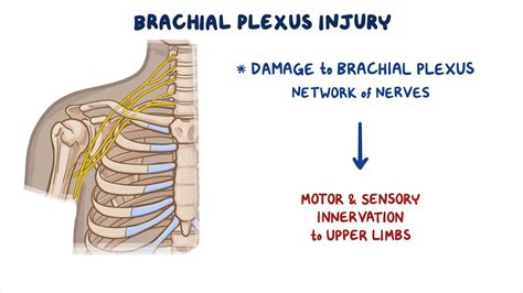 Brachial plexus injury: Nursing - Osmosis Video Library