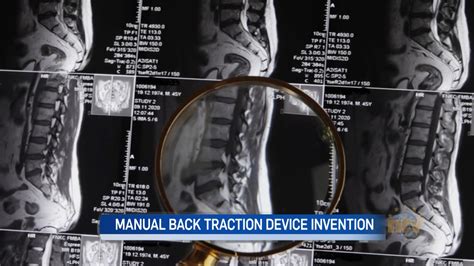 Local man invents back traction device to deal with chronic back pain – NTV