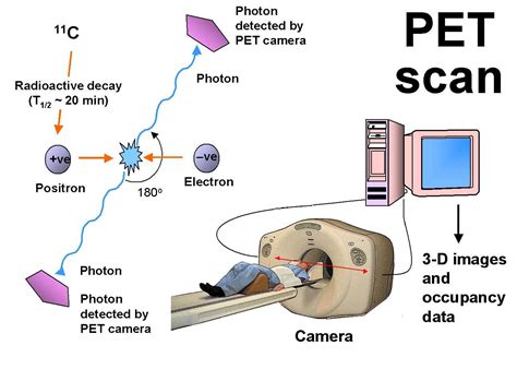 positron emission tomography(PET) is a newer method of imaging which ...