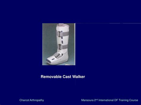 PPT - Charcot Arthropathy . PowerPoint Presentation, free download - ID ...