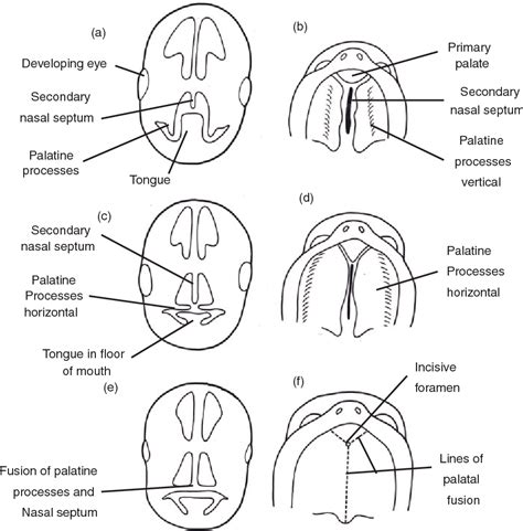 [PDF] Cleft Palate Speech: Assessment and Intervention: Howard/Cleft ...