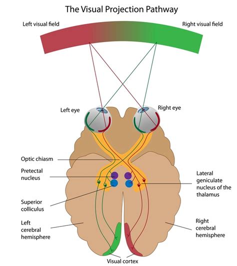 Eye 2 Eye Optometrists: Cortical Visual Impairment