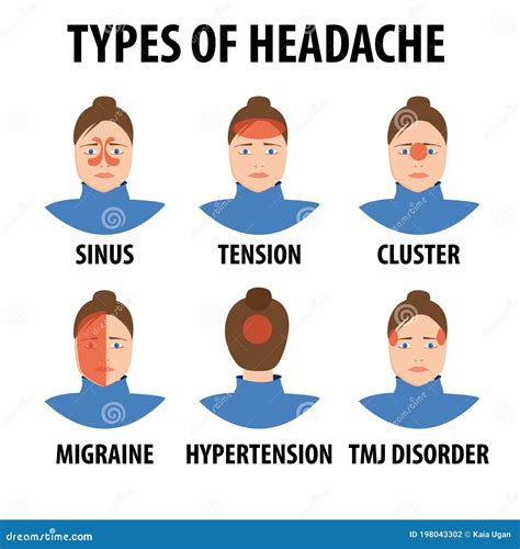 Types Of Headache Vector | CartoonDealer.com #155286506