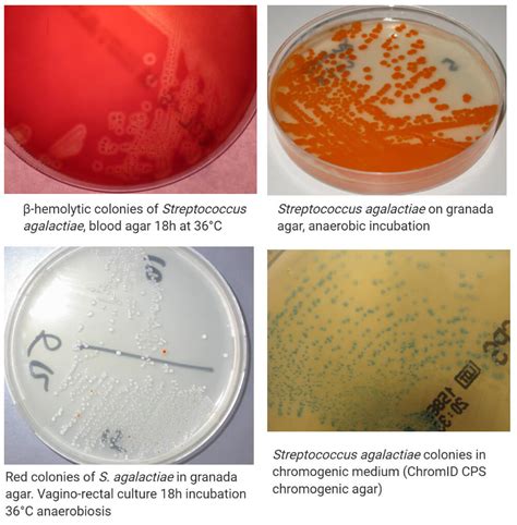 Streptococcus agalactiae- An Overview - Microbe Notes