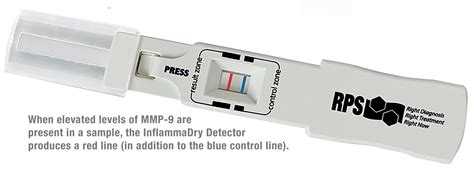 Inflammation Check: A New Test for Dry Eye