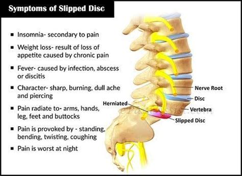 How much does a slipped disc surgery cost in Top Indian Hospitals?