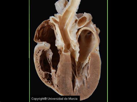 Canine Heart Dissection Anatomy Resources (I & II) - WikiVet English