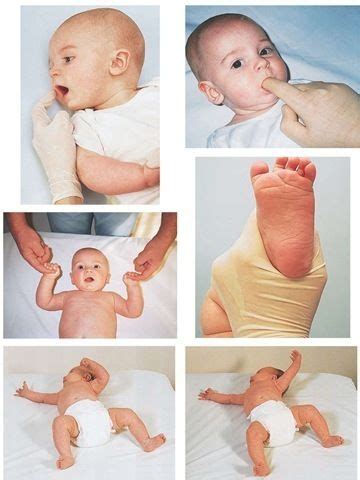 Infant reflexes. Uf Health, Primitive Reflexes, Nursing Board, Sensory ...