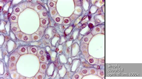 Stratified Cuboidal Labeled