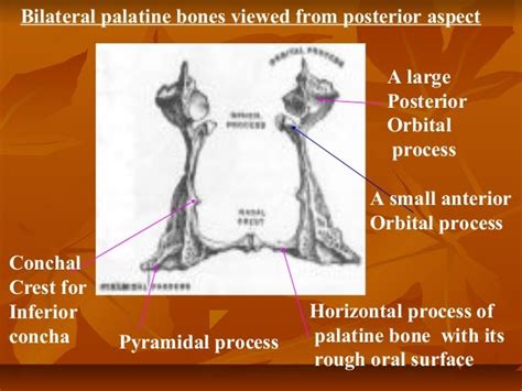 Palatine bone