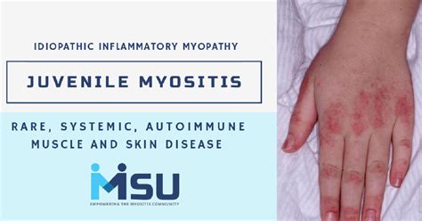 Juvenile Myositis - Myositis Support and Understanding