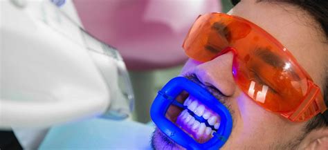 Professional Teeth Whitening | Dentist-administered Whitening Treatments