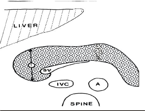 Figure 1 from Sonographic measurement of the antero-posterior diameter ...