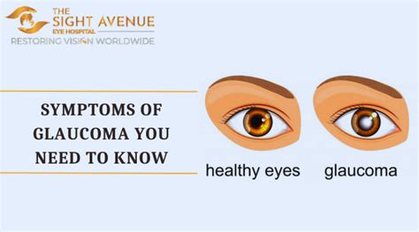 Symptoms of Glaucoma You Need to Know