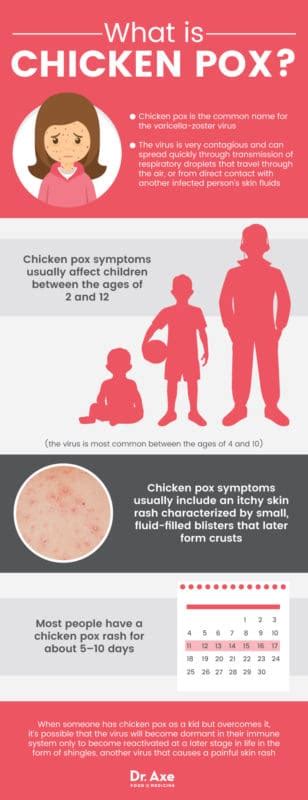 Chicken Pox Symptoms + How to Find Natural Relief - Dr. Axe