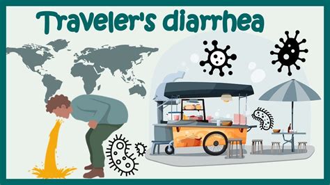 Traveler’s Diarrhea | Causes, Risk Factors, Symptoms, Diagnosis ...