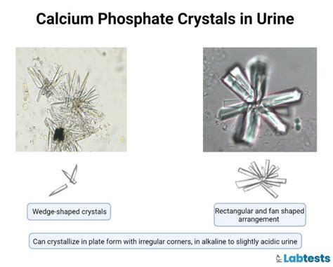 What Causes Eye Crystals at Thomas Reynolds blog