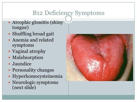 Megaloblastic anaemia