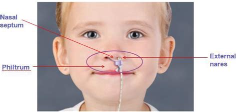 Nasal bridle tube retaining system