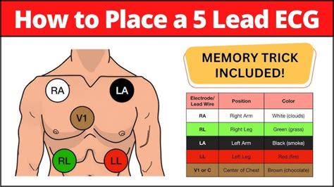 12 Lead ECG Placement: Diagram And Mnemonic For Limb And, 59% OFF